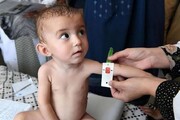 ۲۶۲ هزار کودک مبتلا به سوءتغذیه مشمول خرید سبدغذایی رایگان می شوند